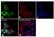 Cyclin Dependent Kinase 5 antibody, MA5-17053, Invitrogen Antibodies, Immunofluorescence image 