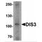 DIS3 Homolog, Exosome Endoribonuclease And 3'-5' Exoribonuclease antibody, MBS153622, MyBioSource, Western Blot image 