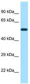 POTE Ankyrin Domain Family Member A antibody, TA338348, Origene, Western Blot image 