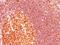 MALT1 Paracaspase antibody, GTX34812, GeneTex, Immunohistochemistry paraffin image 