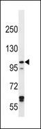 Iron Responsive Element Binding Protein 2 antibody, MBS9213792, MyBioSource, Western Blot image 