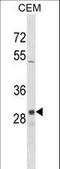 Olfactory Receptor Family 1 Subfamily D Member 2 antibody, LS-C163153, Lifespan Biosciences, Western Blot image 