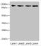 Glutamate Ionotropic Receptor Kainate Type Subunit 3 antibody, LS-C675833, Lifespan Biosciences, Western Blot image 