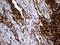 Carboxypeptidase M antibody, LS-C791207, Lifespan Biosciences, Immunohistochemistry paraffin image 