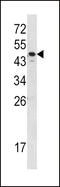 Serpin Family A Member 7 antibody, 62-422, ProSci, Western Blot image 