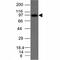 Uveal Autoantigen With Coiled-Coil Domains And Ankyrin Repeats antibody, 33-456, ProSci, Western Blot image 