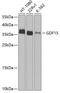 MIC-1 antibody, A01583, Boster Biological Technology, Western Blot image 