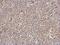 Interleukin 1 Receptor Associated Kinase 4 antibody, PA5-29700, Invitrogen Antibodies, Immunohistochemistry paraffin image 
