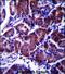 Lysophospholipase Like 1 antibody, PA5-71862, Invitrogen Antibodies, Immunohistochemistry paraffin image 