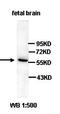 ADP-Ribosylhydrolase Like 2 antibody, orb77414, Biorbyt, Western Blot image 