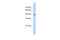 Hydroxyacyl-CoA Dehydrogenase Trifunctional Multienzyme Complex Subunit Beta antibody, 30-357, ProSci, Western Blot image 