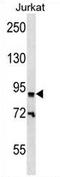 Zinc Finger Protein 780B antibody, AP54718PU-N, Origene, Western Blot image 
