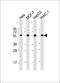 Prolyl 4-Hydroxylase Subunit Beta antibody, M02335-1, Boster Biological Technology, Western Blot image 