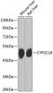 Cytochrome P450 Family 2 Subfamily C Member 18 antibody, A07005-2, Boster Biological Technology, Western Blot image 