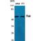 Fyn Related Src Family Tyrosine Kinase antibody, LS-C385771, Lifespan Biosciences, Western Blot image 