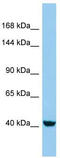 KN Motif And Ankyrin Repeat Domains 4 antibody, TA331551, Origene, Western Blot image 