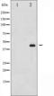 Mitogen-Activated Protein Kinase Kinase 1 antibody, GTX52336, GeneTex, Western Blot image 