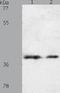 Somatostatin Receptor 1 antibody, TA323285, Origene, Western Blot image 