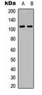 Interleukin 10 Receptor Subunit Alpha antibody, LS-C359025, Lifespan Biosciences, Western Blot image 