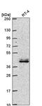 TLE Family Member 4, Transcriptional Corepressor antibody, PA5-66768, Invitrogen Antibodies, Western Blot image 