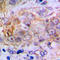 Carbonic Anhydrase 2 antibody, LS-C351900, Lifespan Biosciences, Immunohistochemistry paraffin image 