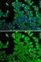 Cellular Retinoic Acid Binding Protein 2 antibody, GTX33118, GeneTex, Immunocytochemistry image 