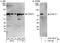 Cleavage And Polyadenylation Specific Factor 3 antibody, A301-090A, Bethyl Labs, Western Blot image 