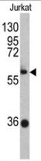 Zinc Finger And BTB Domain Containing 2 antibody, AP17851PU-N, Origene, Western Blot image 