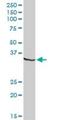 Dynein Axonemal Light Intermediate Chain 1 antibody, H00007802-D01P, Novus Biologicals, Western Blot image 