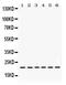 BCL2 Interacting Killer antibody, PB9755, Boster Biological Technology, Western Blot image 