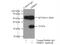 Dehydrogenase/Reductase 3 antibody, 15393-1-AP, Proteintech Group, Immunoprecipitation image 