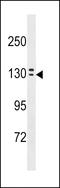 Ovochymase 1 antibody, LS-C158023, Lifespan Biosciences, Western Blot image 