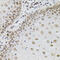 Transglutaminase 2 antibody, 13-350, ProSci, Immunohistochemistry paraffin image 