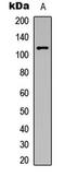 Protein Kinase D1 antibody, LS-C358251, Lifespan Biosciences, Western Blot image 