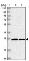 Metaxin 2 antibody, PA5-56779, Invitrogen Antibodies, Western Blot image 