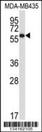 Protein Disulfide Isomerase Family A Member 5 antibody, 57-491, ProSci, Western Blot image 