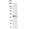 Eukaryotic Translation Initiation Factor 2 Alpha Kinase 3 antibody, R31135, NSJ Bioreagents, Western Blot image 