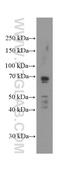 Mesothelin antibody, 66404-1-Ig, Proteintech Group, Western Blot image 