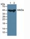 Adenosine Kinase antibody, LS-C725353, Lifespan Biosciences, Western Blot image 