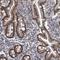 Epithelial Splicing Regulatory Protein 1 antibody, NBP1-82202, Novus Biologicals, Immunohistochemistry frozen image 