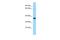 Coiled-Coil Domain Containing 9B antibody, A15077, Boster Biological Technology, Western Blot image 