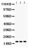 Baculoviral IAP Repeat Containing 5 antibody, LS-C357607, Lifespan Biosciences, Western Blot image 