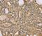 Centromere Protein V antibody, MBS2518495, MyBioSource, Immunohistochemistry paraffin image 