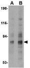 Syntaphilin antibody, GTX85397, GeneTex, Western Blot image 