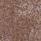Phosphopantothenoylcysteine Decarboxylase antibody, PA5-61065, Invitrogen Antibodies, Immunohistochemistry frozen image 