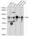 G Protein-Coupled Receptor Kinase 4 antibody, A04238, Boster Biological Technology, Western Blot image 