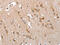 Tumor Protein P53 Binding Protein 2 antibody, CSB-PA948343, Cusabio, Immunohistochemistry paraffin image 