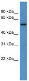 Poly(A) RNA polymerase GLD2 antibody, TA330998, Origene, Western Blot image 