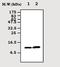 Hemoglobin Subunit Beta antibody, ab77125, Abcam, Western Blot image 