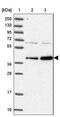 Rab Geranylgeranyltransferase Subunit Alpha antibody, NBP1-87197, Novus Biologicals, Western Blot image 